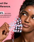 Hydrocolloid Pimple Patches