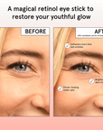 restoring eye balm - grace & stella