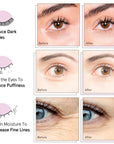Comparison of grace & stella eye patches showing before and after results for reducing dark circles, puffiness, and enhancing hydration.