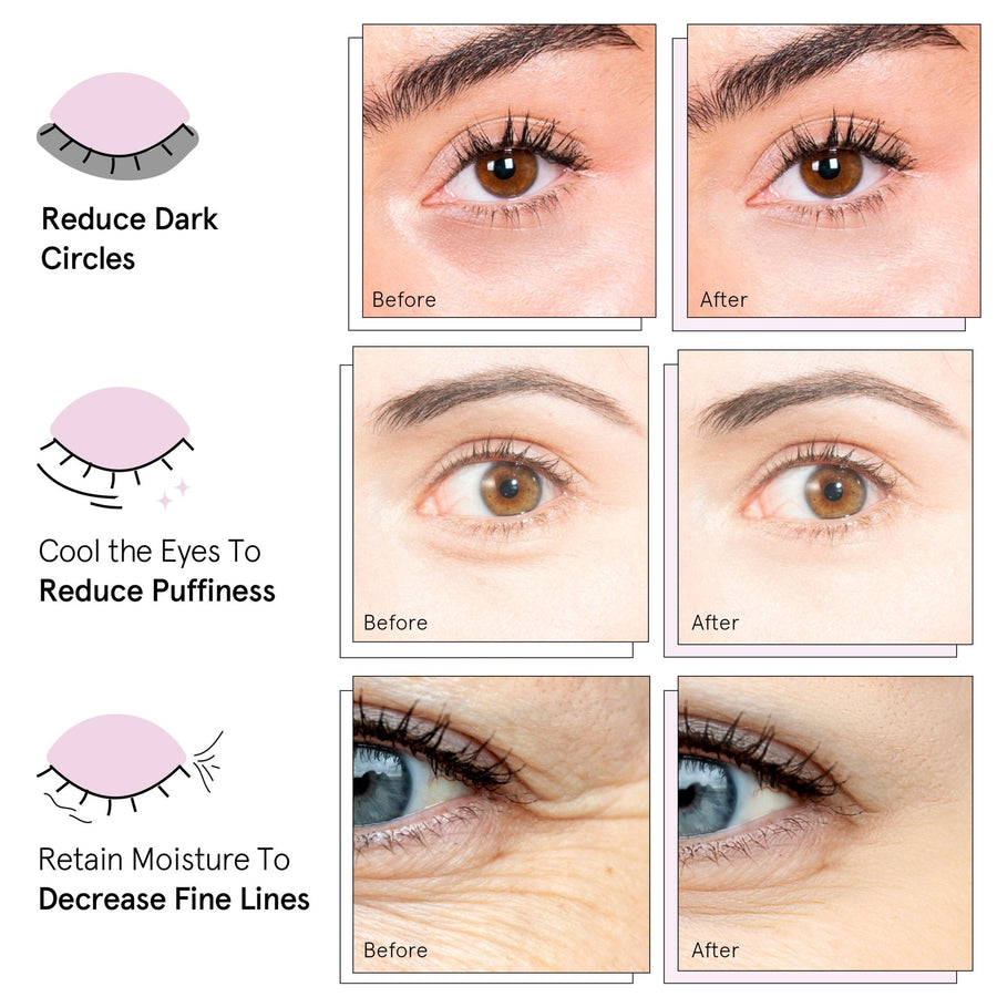 Comparison of grace & stella eye patches showing before and after results for reducing dark circles, puffiness, and enhancing hydration.