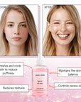 Before and after comparison of a woman's skin, depicting the benefits of using Grace & Stella facial rose spray, including reduced puffiness and redness, controlled oil, balanced skin pH, and an anti-inflammatory effect.