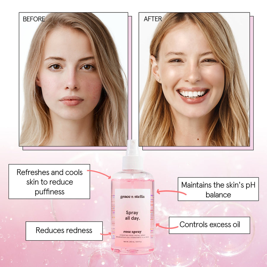 Before and after comparison of a woman's skin, depicting the benefits of using Grace & Stella facial rose spray, including reduced puffiness and redness, controlled oil, balanced skin pH, and an anti-inflammatory effect.