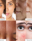 A composite image showing before and after results for various skin treatments: increased radiance, increased hydration, reduced acne, and reduced redness thanks to grace & stella's rose spray.
