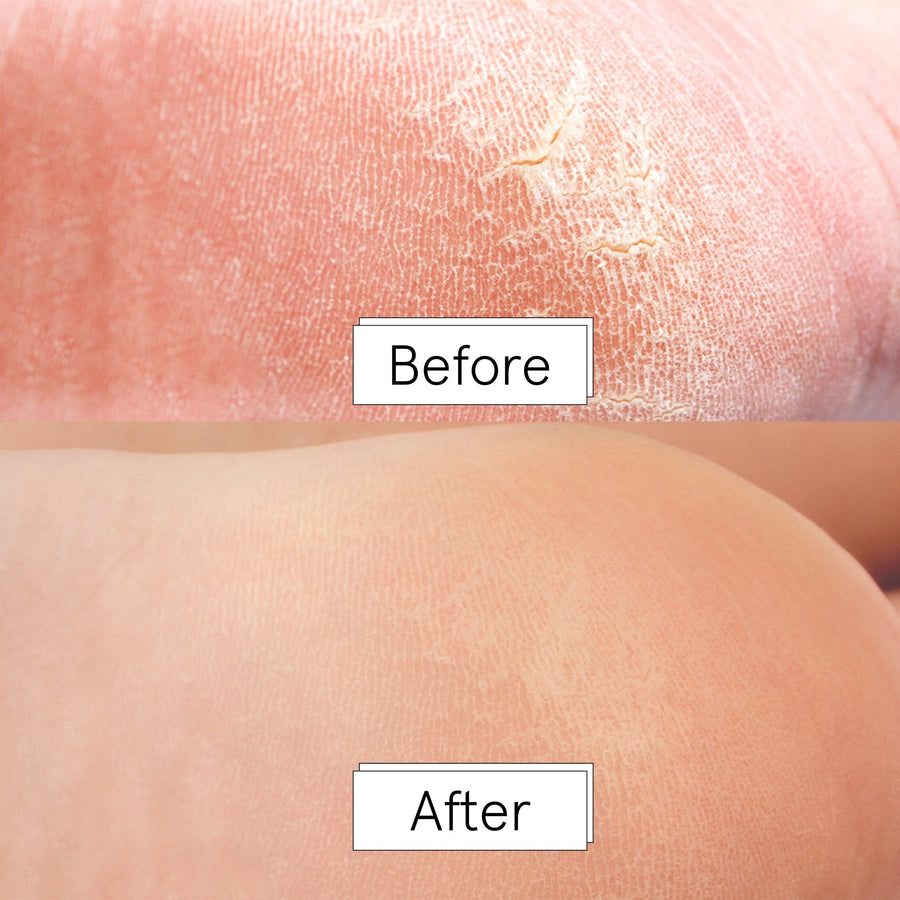 foot peeling mask (4 pairs) free gift - grace & stella