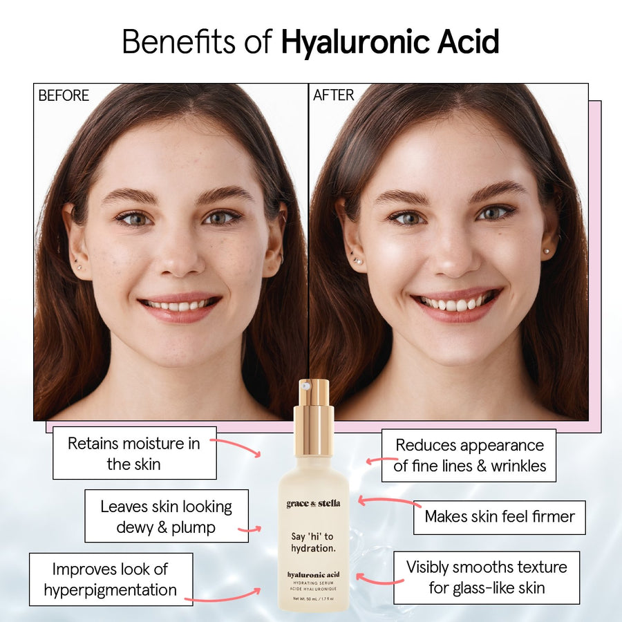 Comparison of skin condition before and after using grace & stella's hyaluronic acid serum, highlighting the product's benefits in enhancing skin hydration and firmness.